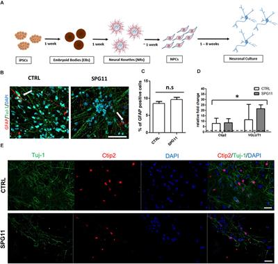 Tideglusib Rescues Neurite Pathology of SPG11 iPSC Derived Cortical Neurons